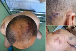 IZBOLA MUŽA 16 PUTA NOŽEM DOK JE SPAVAO U KREVETU! Nastavljeno suđenje Jasni M. iz Zrenjanina, oglasio se advokat za Kurir: Dosad je 5 različitih iskaza dala